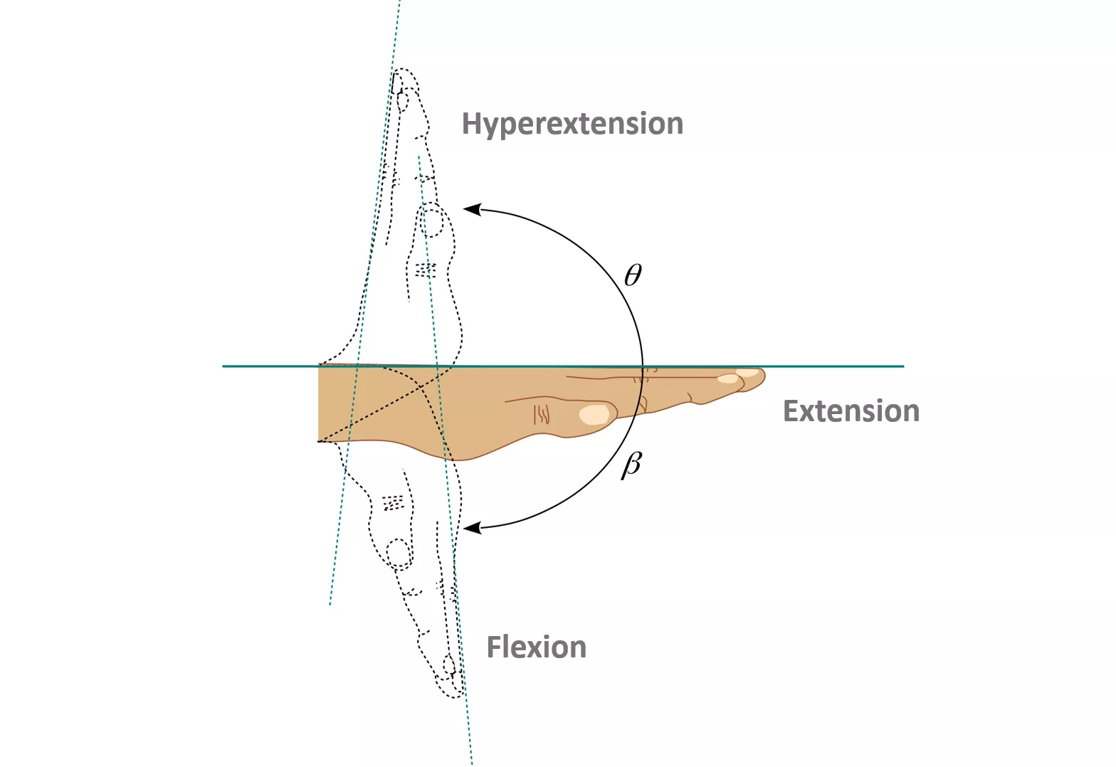 Degrees of freedom of hand